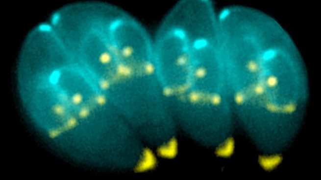 Toxoplasma gondii: el parásito que podría lograr que un humano se quite la vida