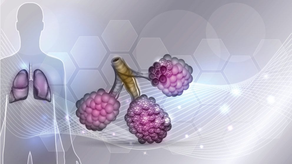 La fibrosis pulmonar es causada por cicatrices en los pulmones, lo que dificulta la respiración.