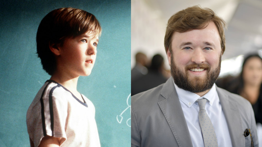 El antes y después de Haley Joel Osment.