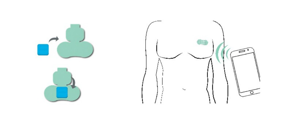 SkinTemp: La nueva tirita infantil que indica la temperatura corporal del niño