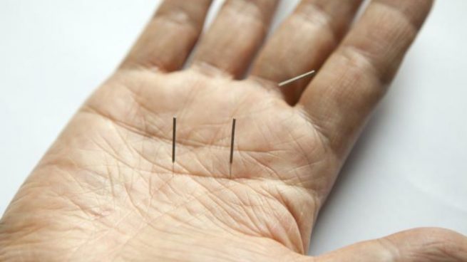 Descubre los principales puntos de acupuntura