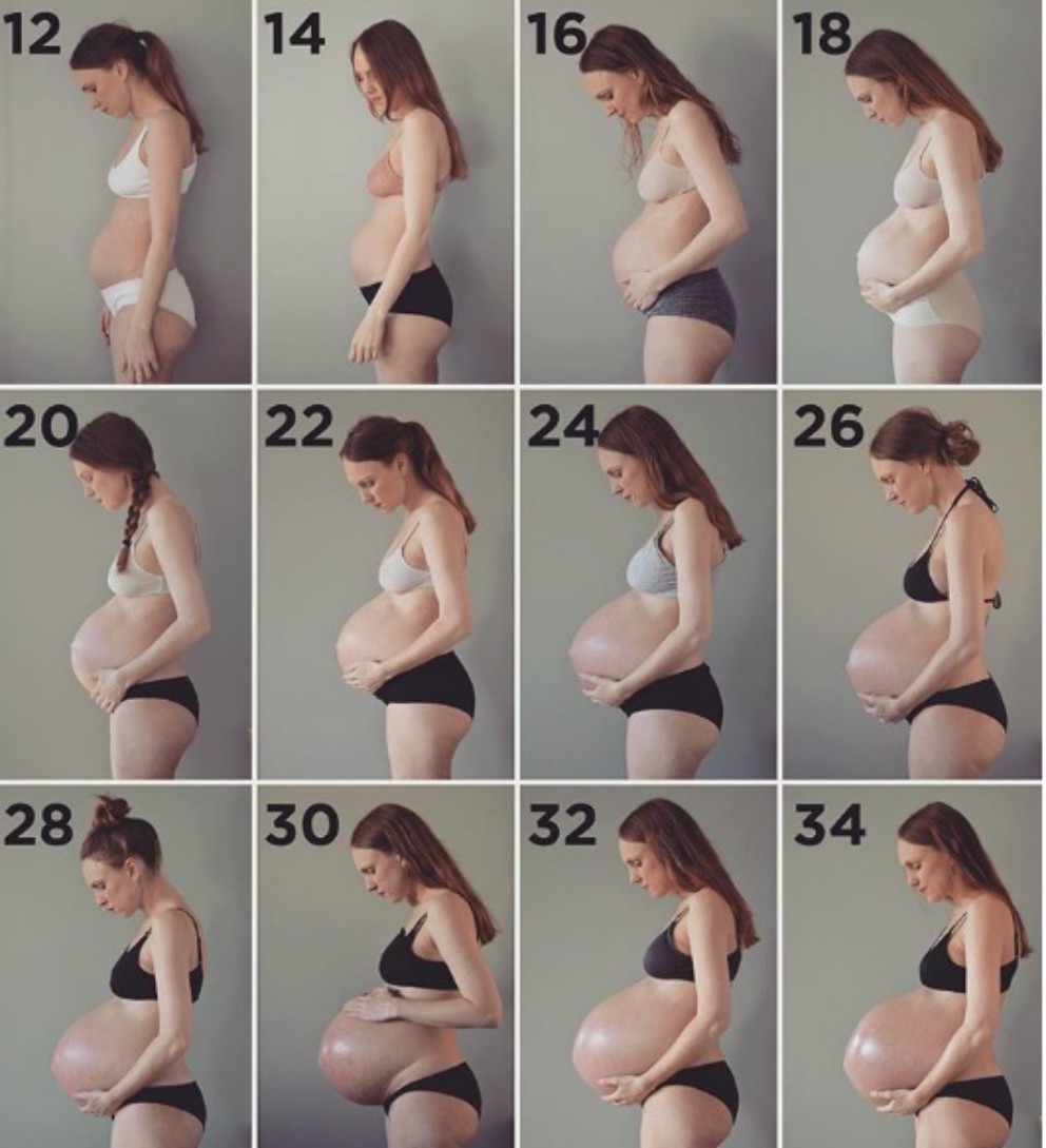 embarazo de trillizos