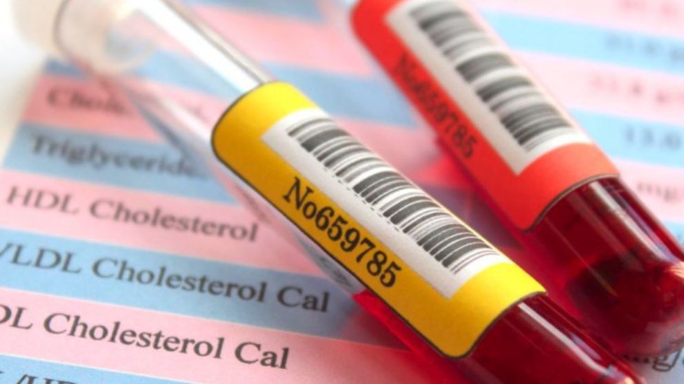Todos los pasos para prepararse para un análisis de sangre