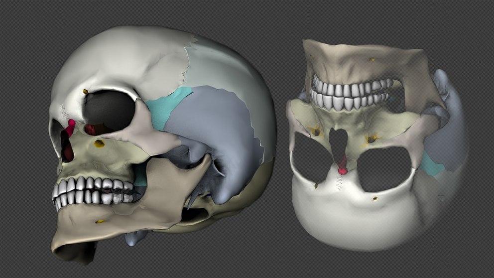 Aprende cuáles son los huesos del cráneo y la cabeza