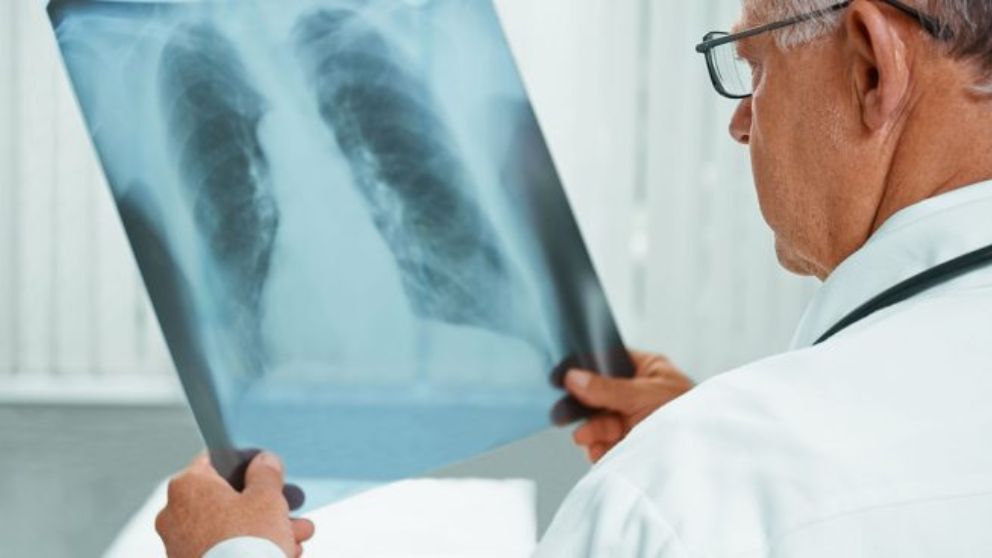 Nuevo avance para saber más sobre la gripe.