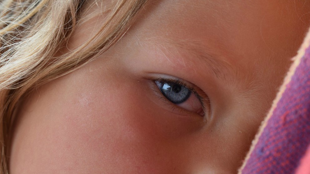 Conjuntivitis en niños