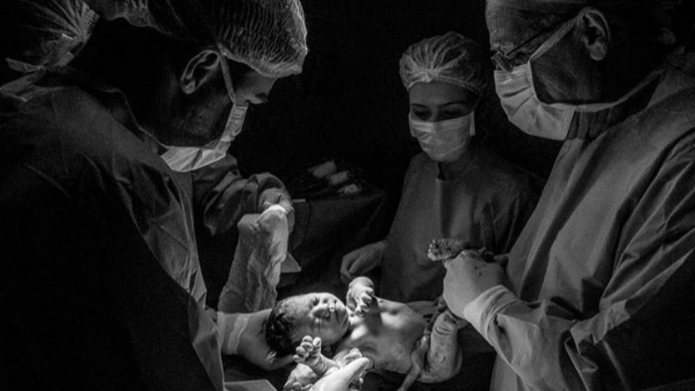 Espectaculares imágenes sobre cómo se vive el parto
