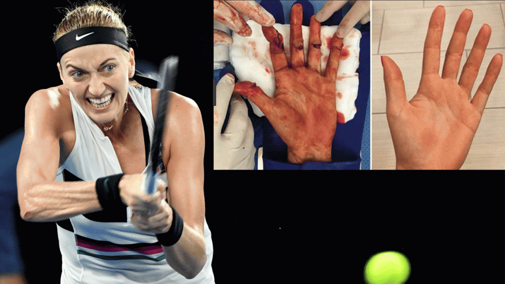 Petra Kvitova. Getty)