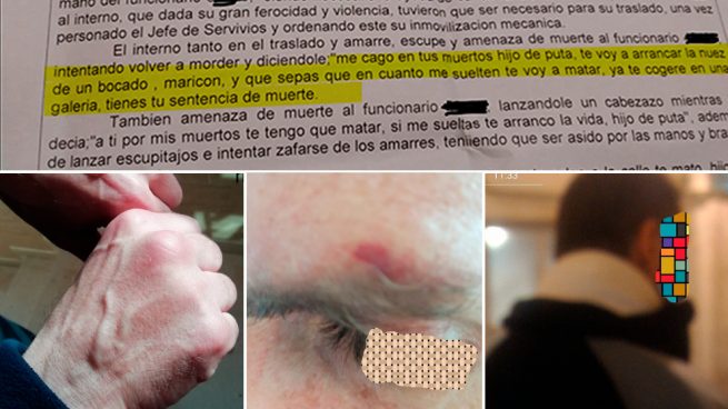La brutal agresión del ‘Hannibal Lecter’ español tras limitar Interior su régimen de aislamiento en prisión