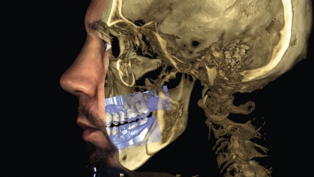 El escáner facial 3D, la revolución tecnológica en odontología