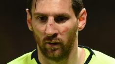 Leo Messi se quedó con este aspecto tras chocar con Smalling. (AFP)