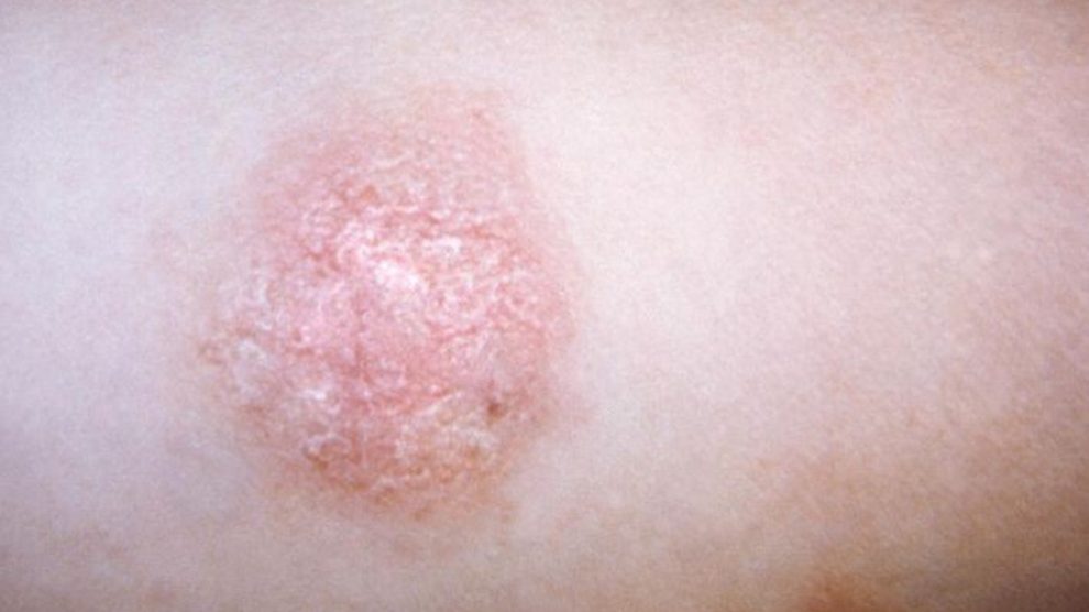 Para cuidar la piel especialmente durante la menopausia debemos tener una atención muy especial a la hidratación de la piel.
