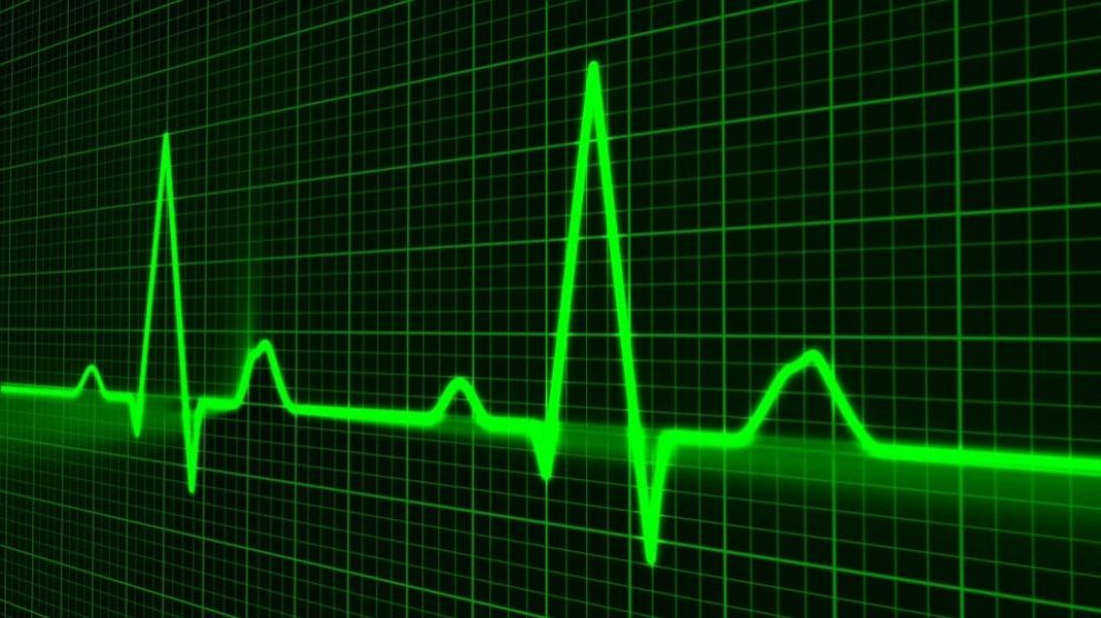 Conoce las diferencias entre paro cardíaco e infarto
