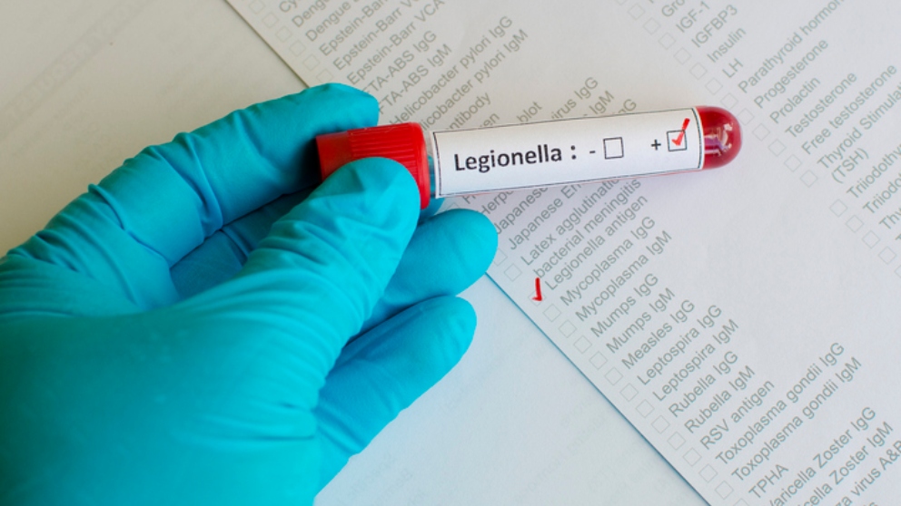 Legionella.