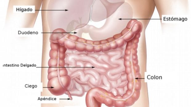 vólvulo intestinal