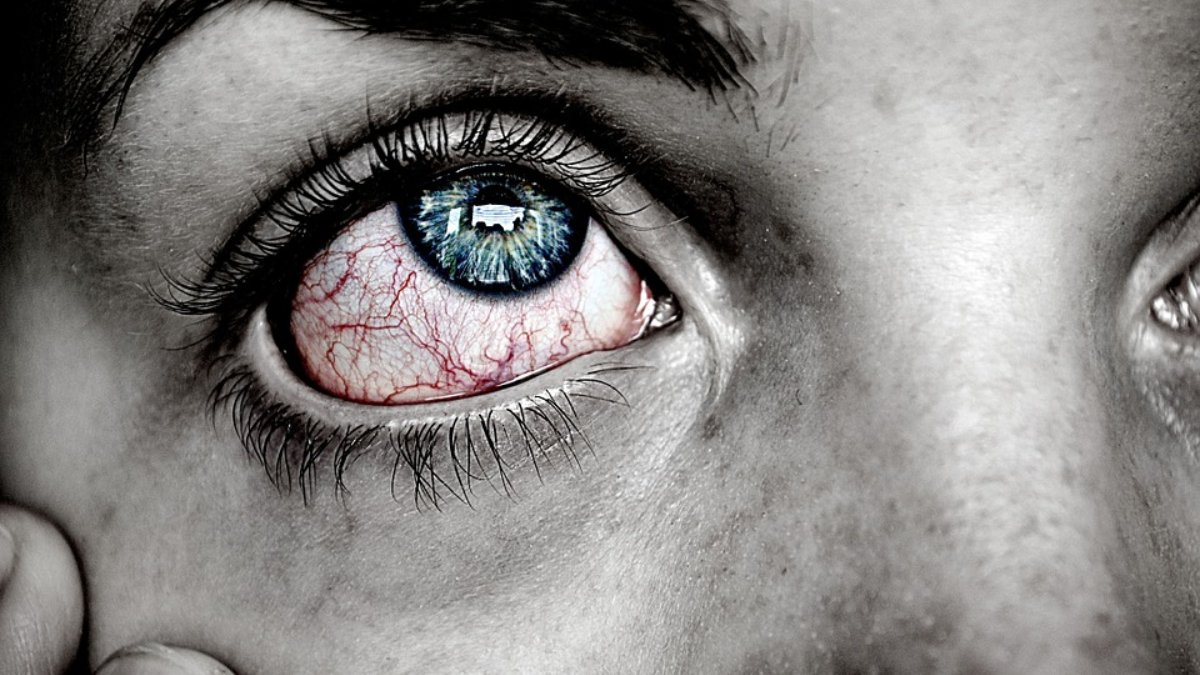 Ojos rojos: estas son sus causas y remedios