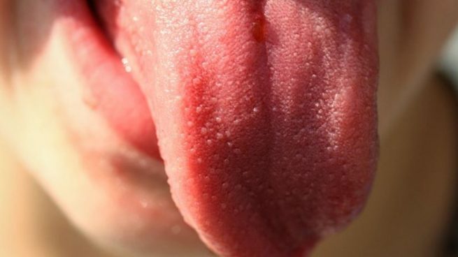Cerca del 50% de las bacterias de la boca viven en la superficie de la lengua.