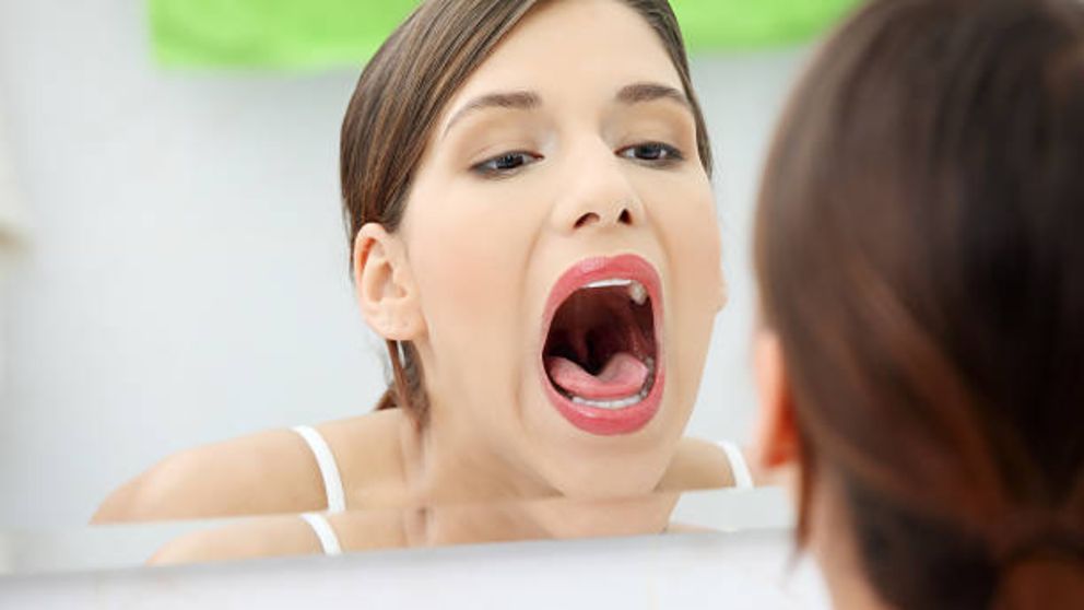 como tratar la estomatitis
