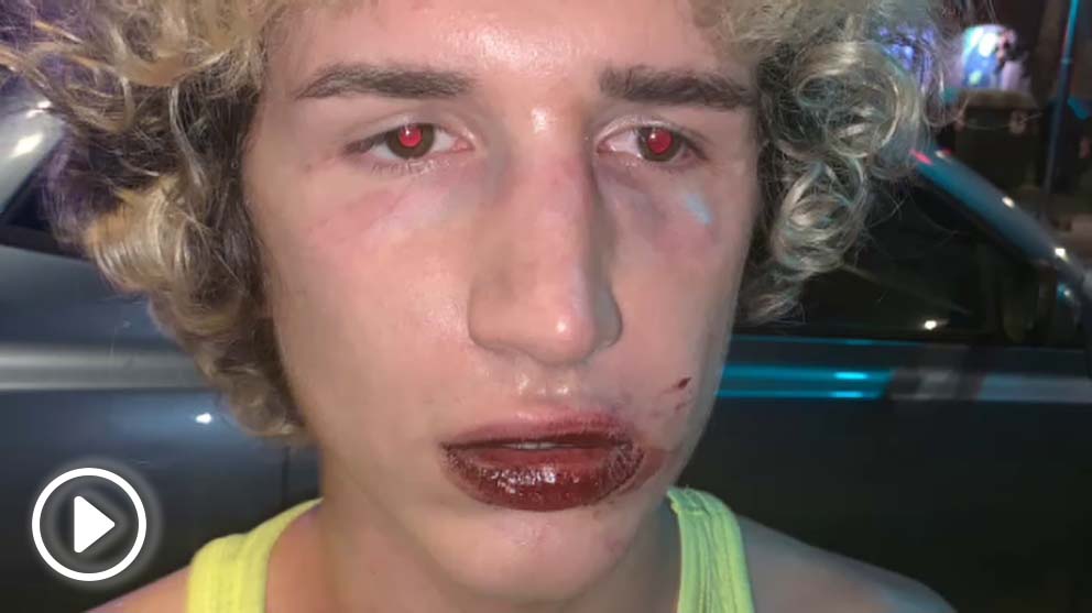 Brutal paliza a un joven italiano a la salida de una discoteca de ambiente gay en Valencia.