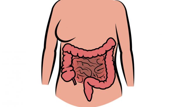 el vólvulo intestinal