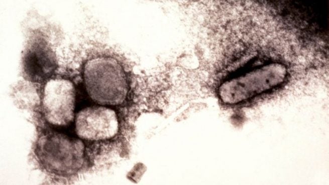 vacuna de la viruela