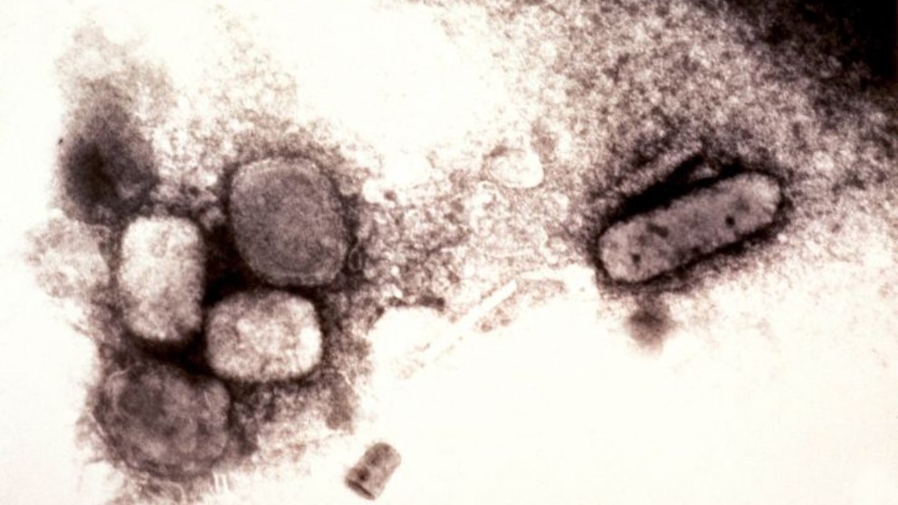 Conoce quién descubrió la vacuna de la viruela