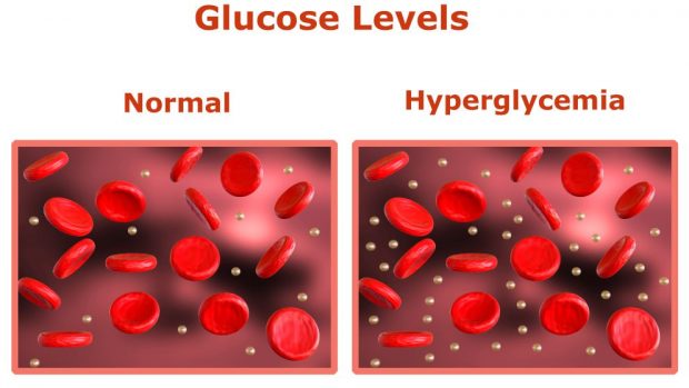 Causas de la hiperglucemia