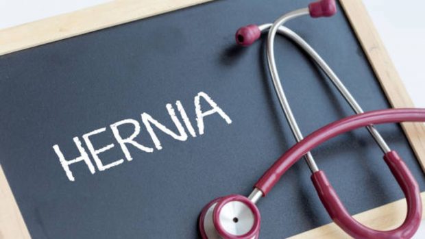 hernia inguinal