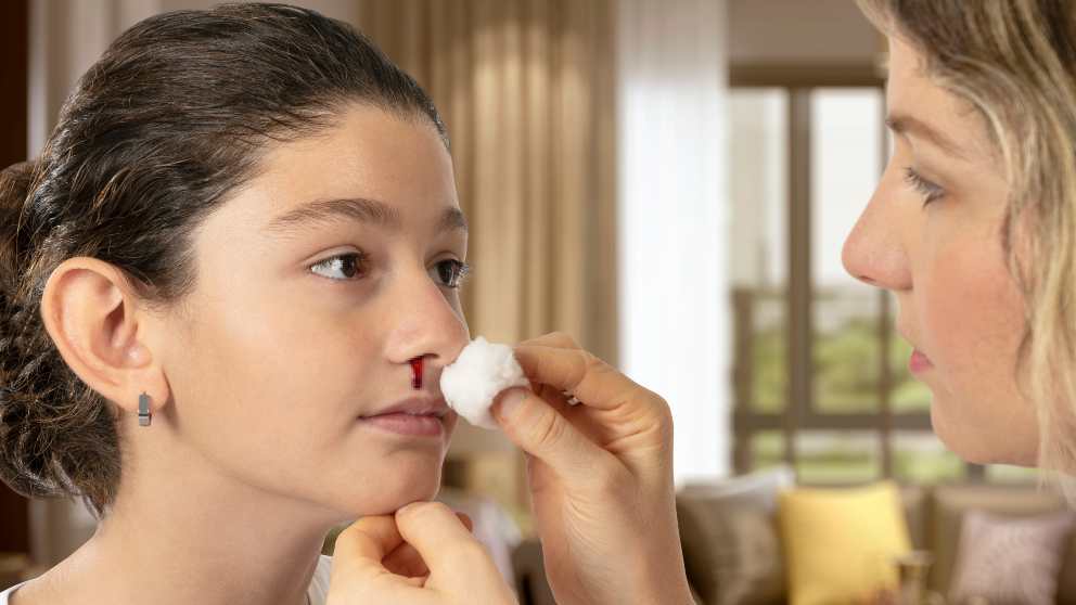 ¿Cómo tratar la hemorragia nasal en niños?