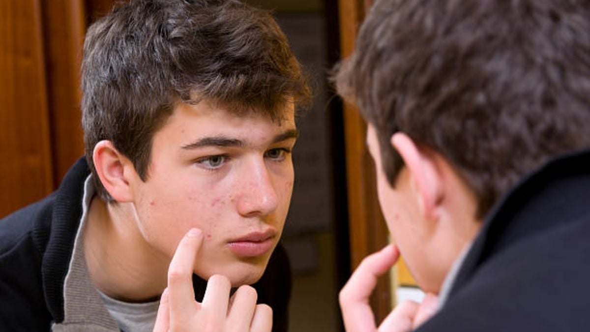Cómo tratar el acné en la adolescencia