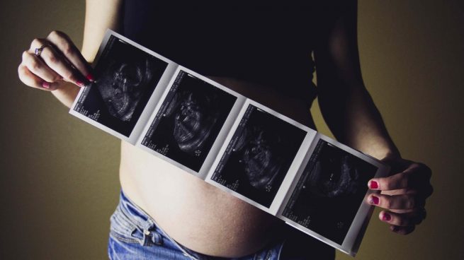 Cuántas ecografías realizar durante el embarazo