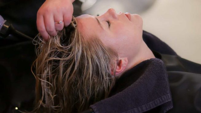 ¿Cómo teñir tu cabello si tienes psoriasis?