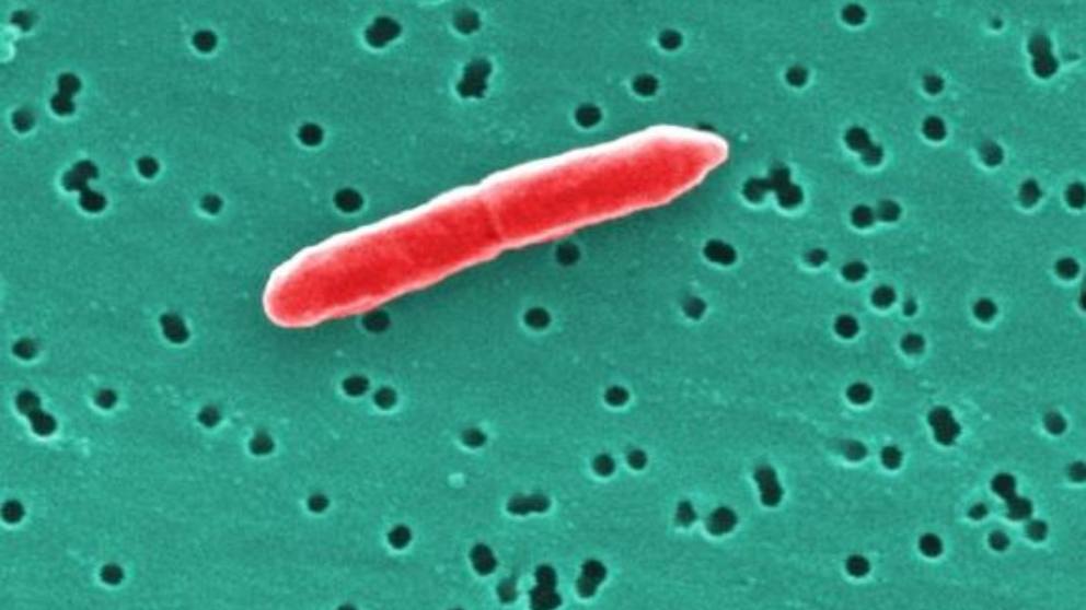 Causas de la infección de orina