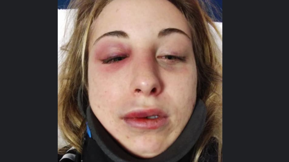 Facebook: Publica fotos después de recibir una paliza de su novio