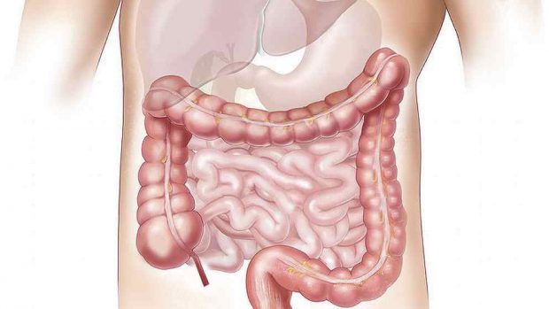 Qué es la disbiosis intestinal