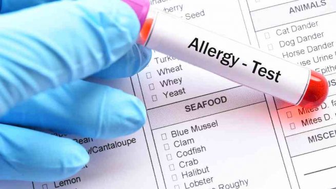 Text alergia alimentos