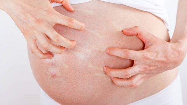 Picor en el embarazo: Causas y cuándo hay que preocuparse