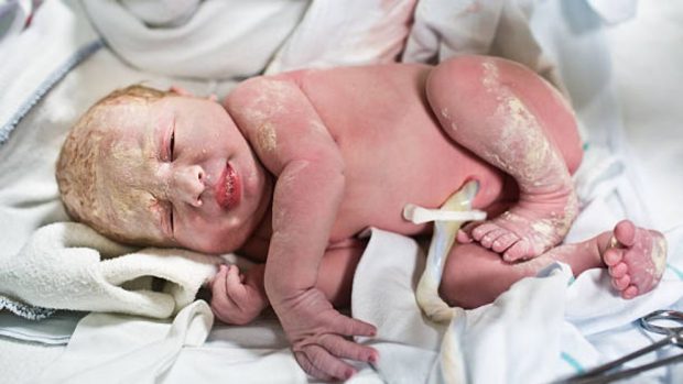 Vérnix caseoso del recién nacido, ¿qué es y para qué sirve"
