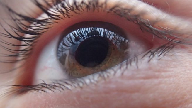 Moscas volantes alrededor de los ojos: causas y cómo quitarlas