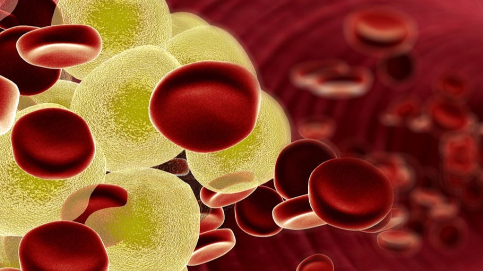 La vacuna contra el colesterol será una realidad en Reino Unido