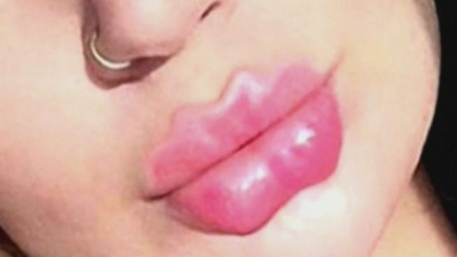 Labios del diablo, la última locura en Instagram