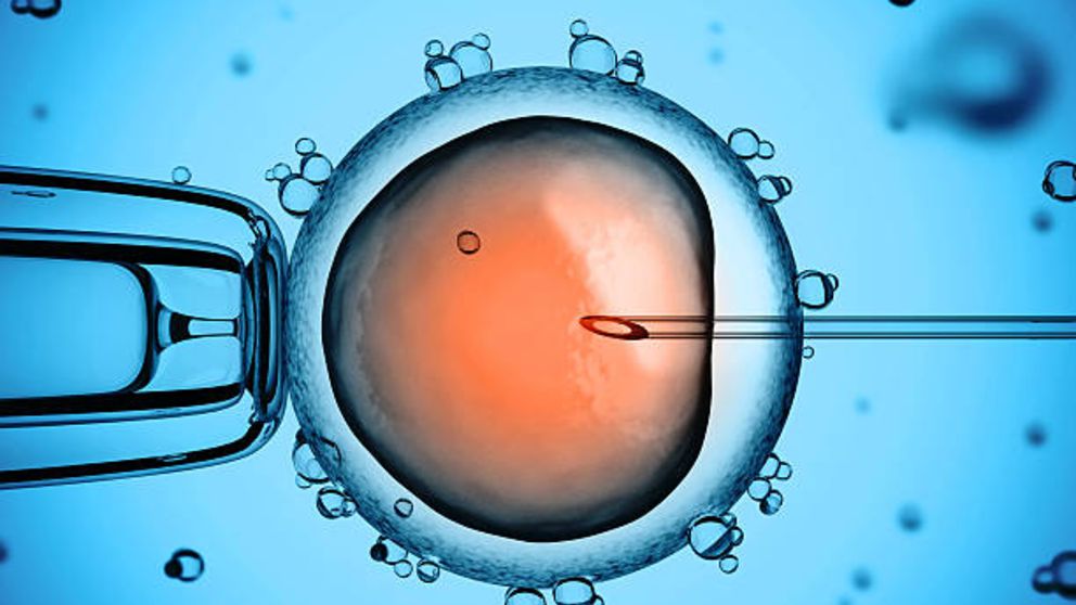 Fecundación in vitro preguntas que hacer antes de realizar el tratamiento
