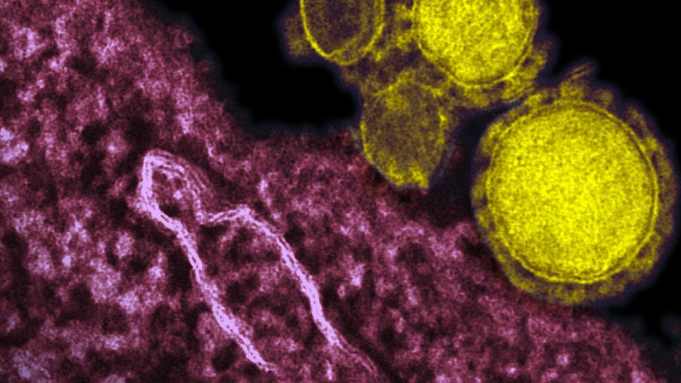 Imagen del nuevo coronavirus detectado en China.