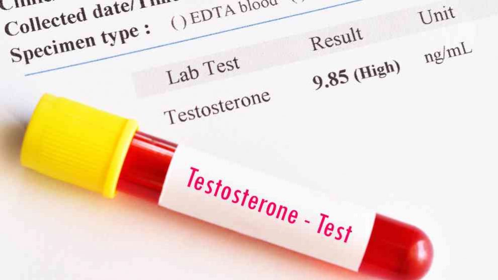 ¿Cómo tratar el déficit de testosterona?