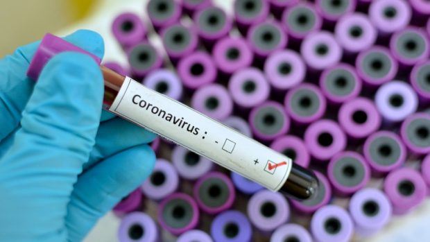 ¿Cómo prevenir el coronavirus?