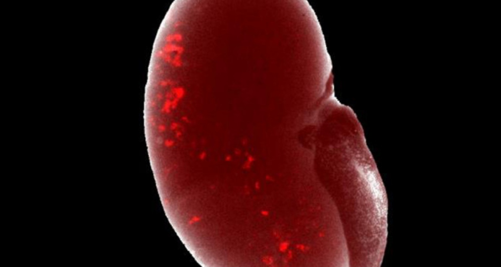 Es necesario dejar de fumar para reducir la progresión del cáncer de riñón.