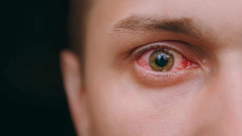 Cuidado de los ojos y lesiones en la retina