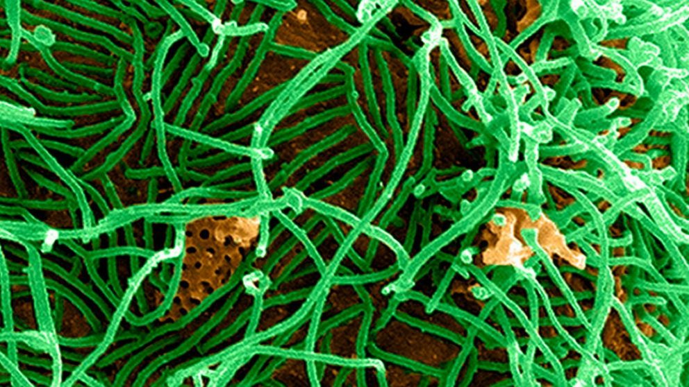 El virus del Ébola podría ayudar a combatir el tumor cerebral