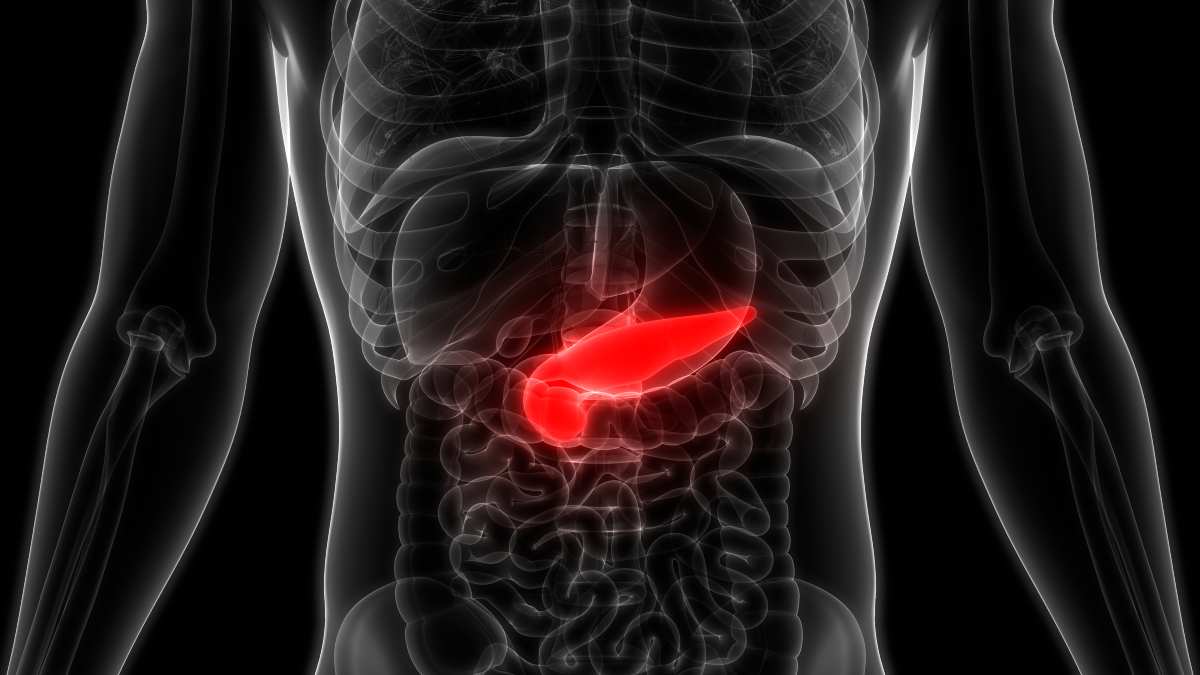 Avances sobre el cáncer de páncreas.