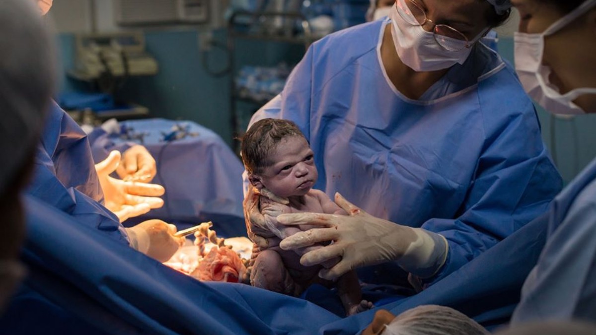Facebook: La foto del bebé que nace enfadado y sin llorar se hace viral
